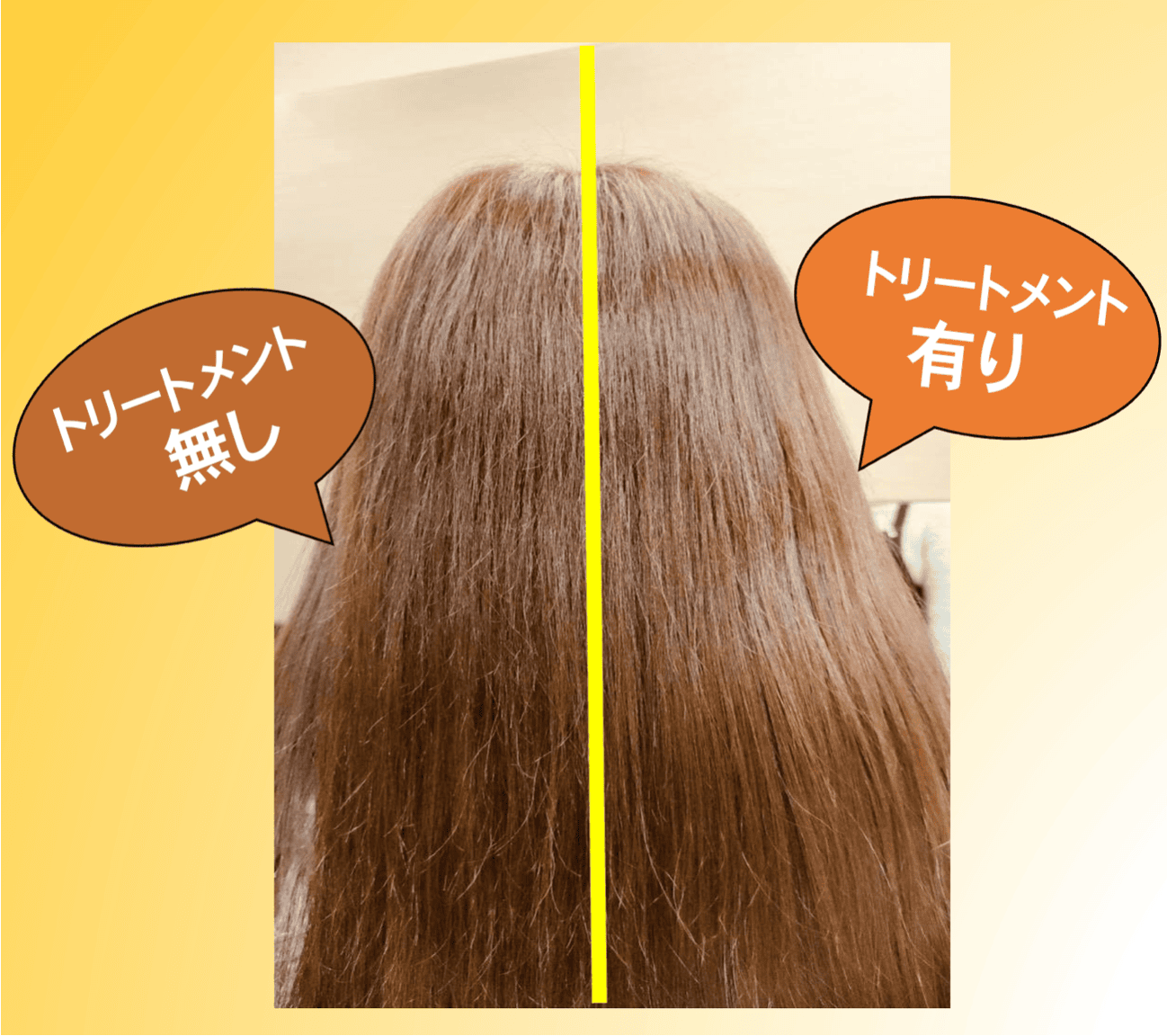 スマイルカラー